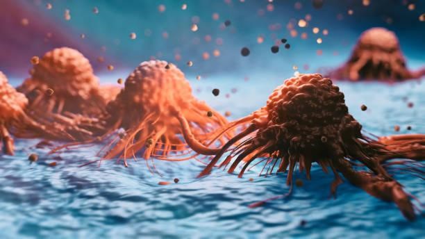 Things To Know About Cancer at Stage 4